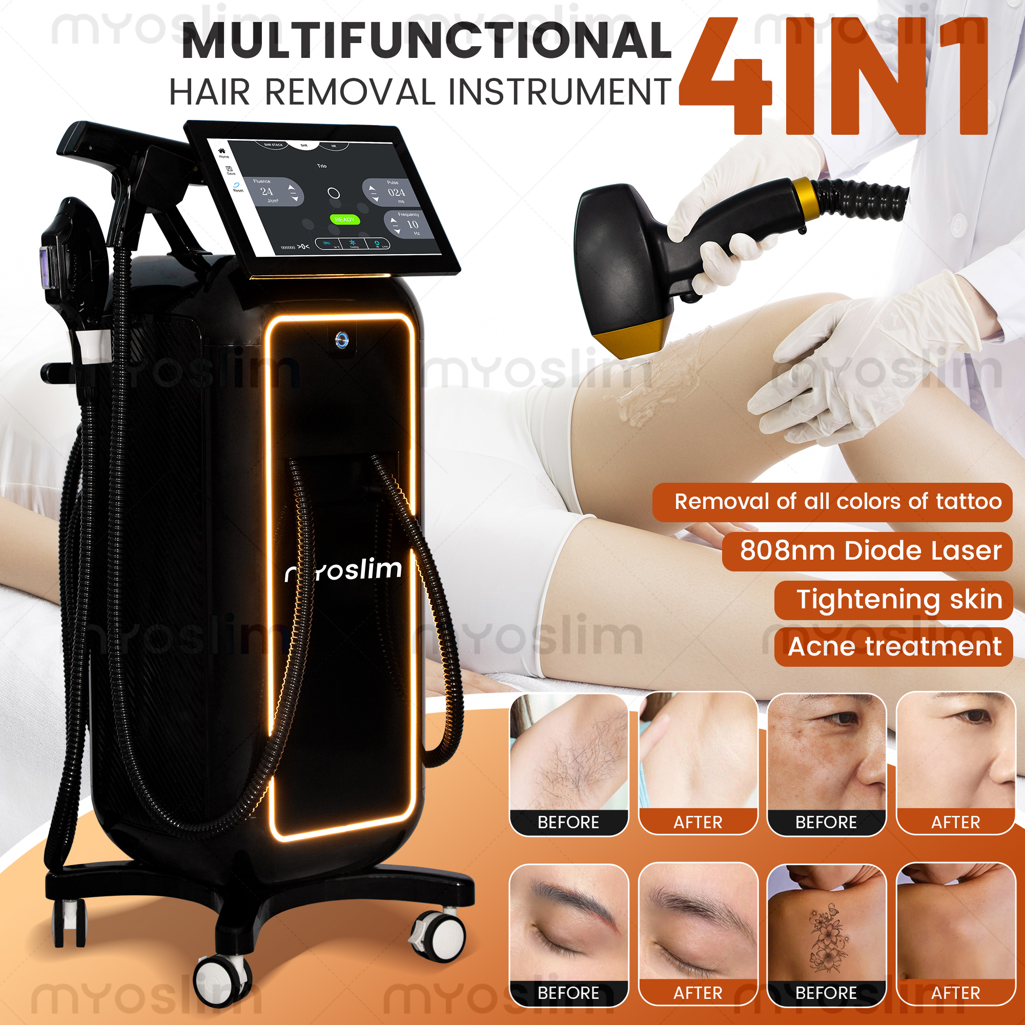 Soprano 4 in 1  Diode Laser Ha - đánh giá và giá Industrial Laser Cleaning Machine