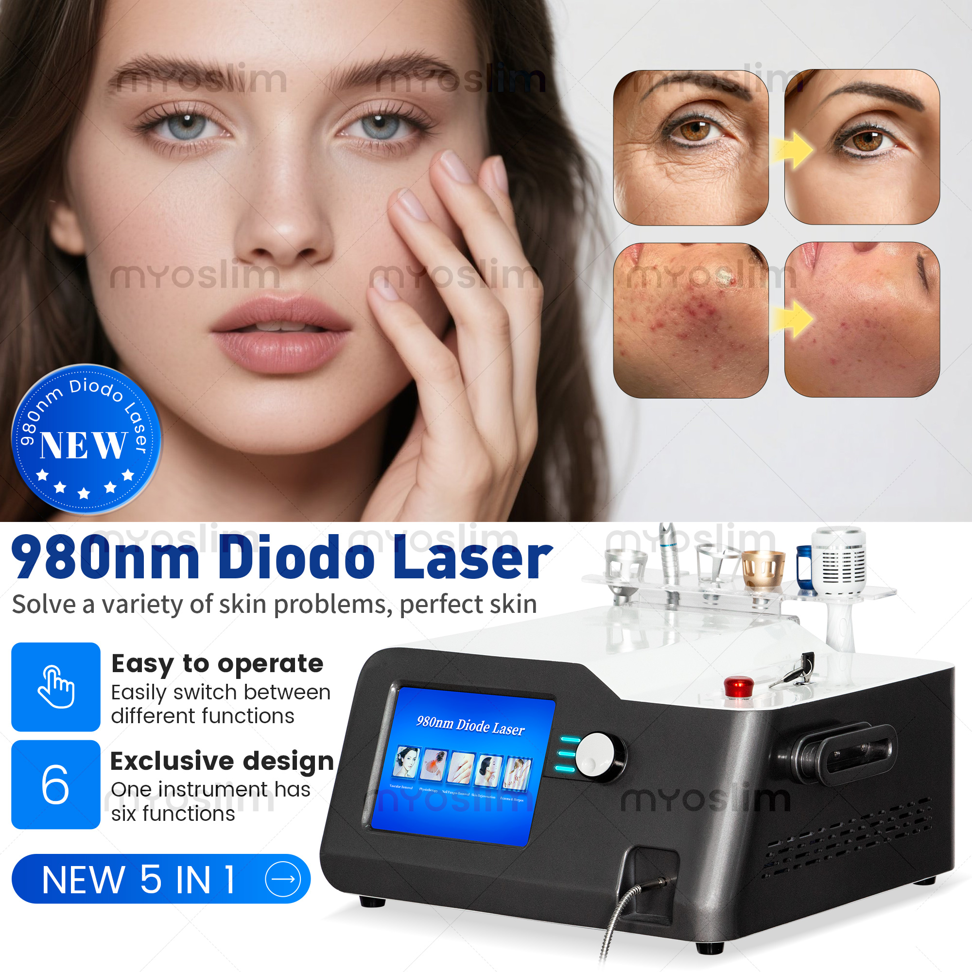 Portable 30W 5 in 1 980 nm Dio - đánh giá và giá Industrial Laser Cleaning Machine